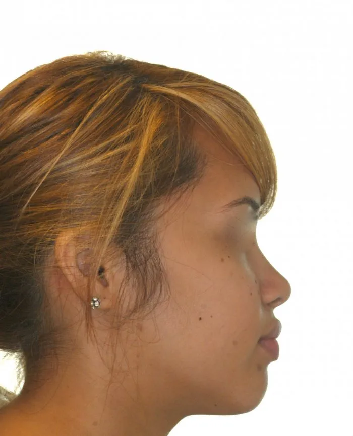 side view of young girl - right side 
