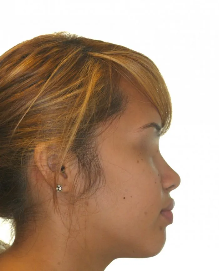 side view of young girl - right side