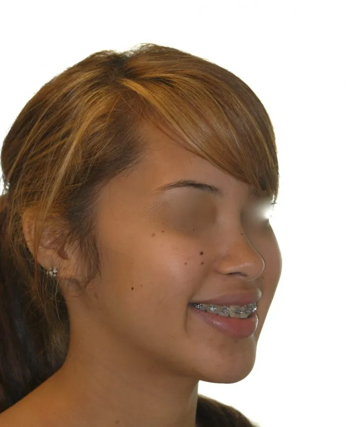 side view of young girl - left side