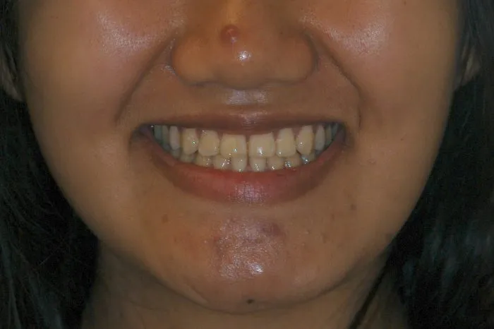 view of a smiling woman