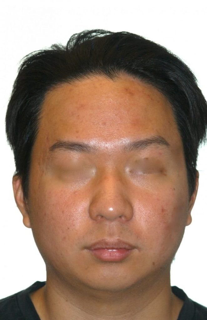 front view of man