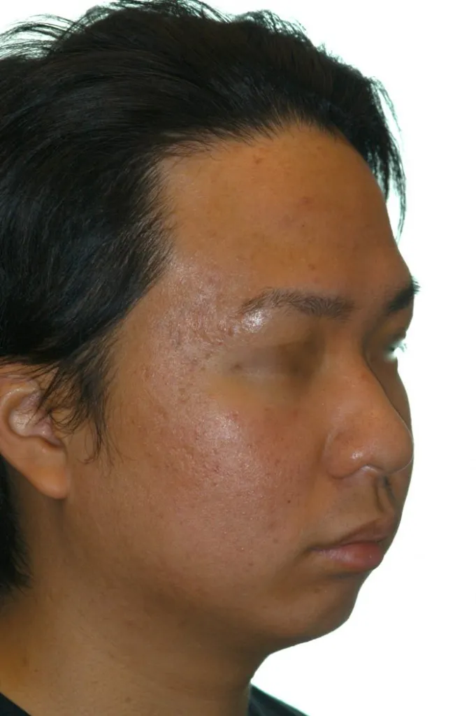 side view of man- right jaw