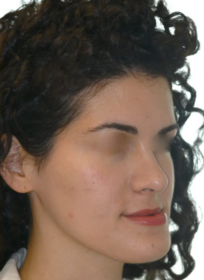 view of woman right jaw line