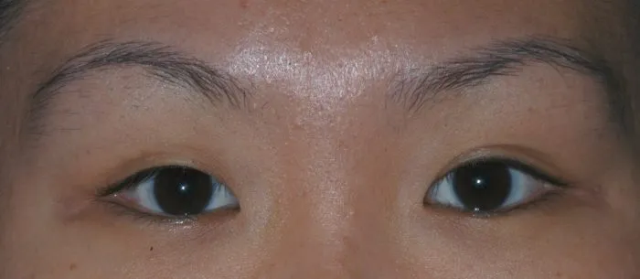 picture of face - eyes only