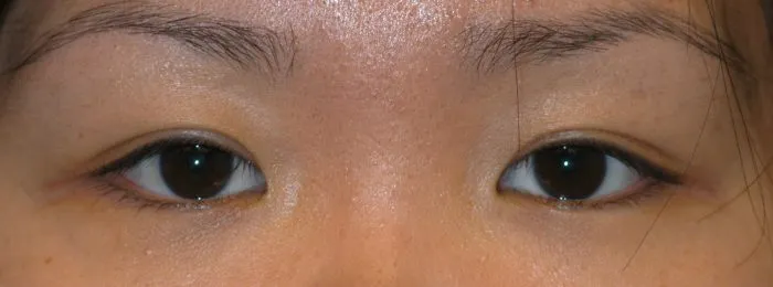 picture of face - eyes only