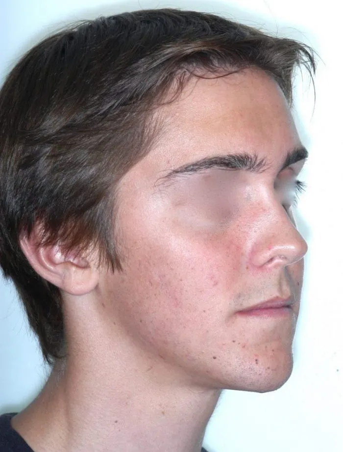 right side view of young boy 