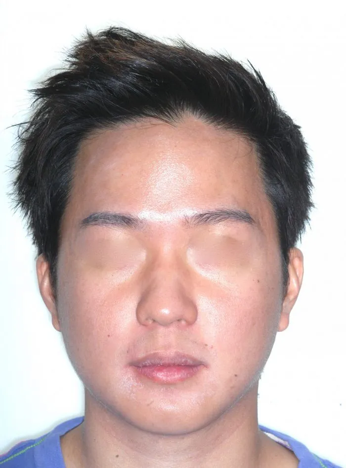 front view of man
