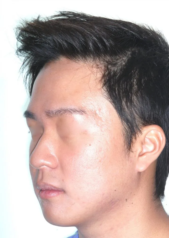 view of man -right jaw