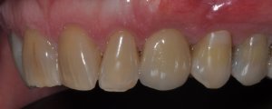 top closeup picture of teeth