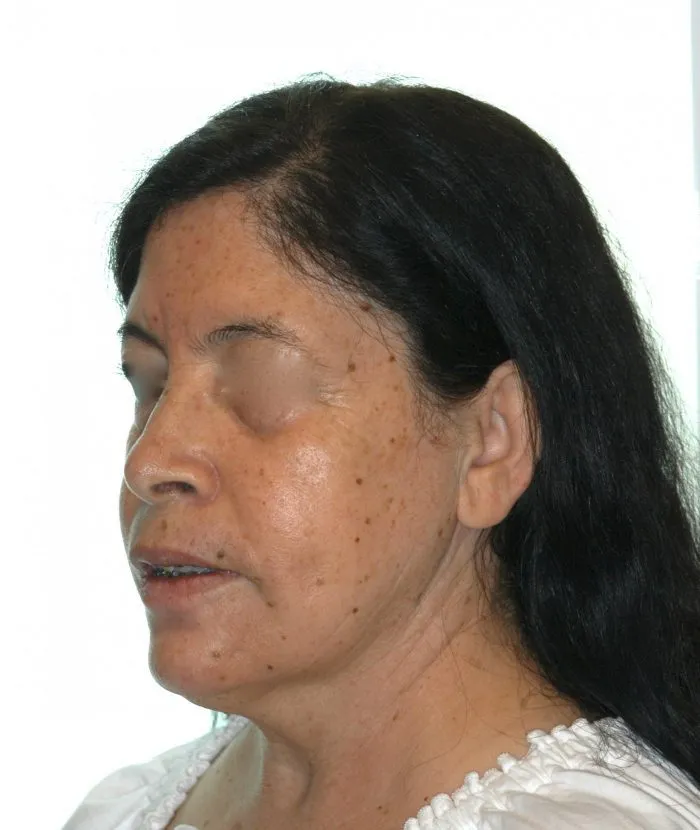 side view of a woman with brown hair - view of left jaw
